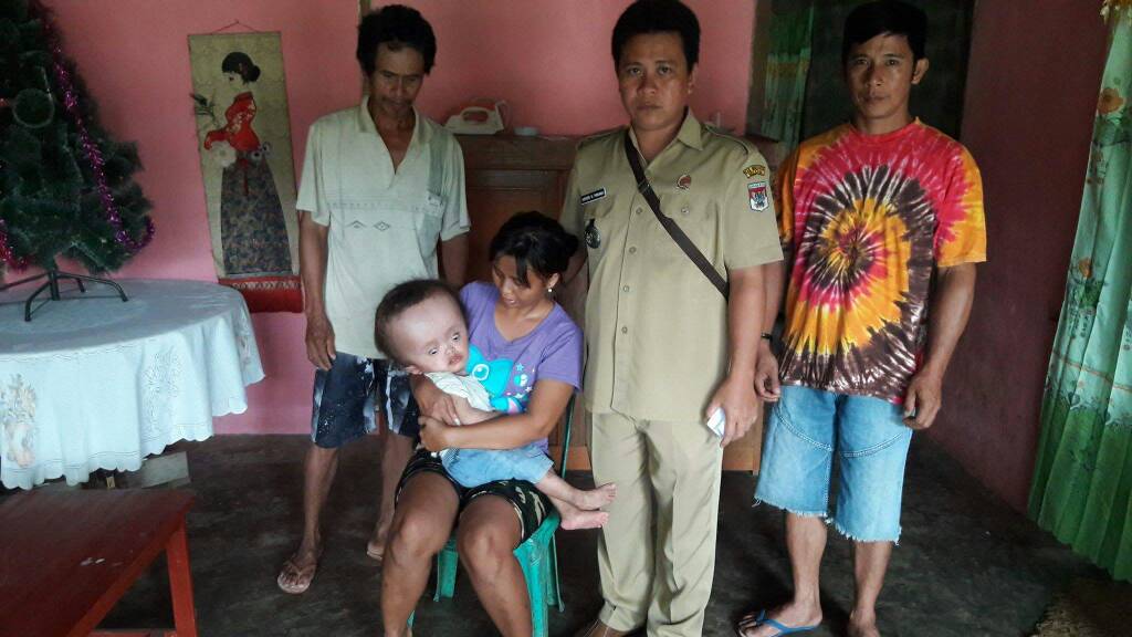 Juliandro, Balita Penderita Hydrocephalus Butuh Biaya Pengobatan