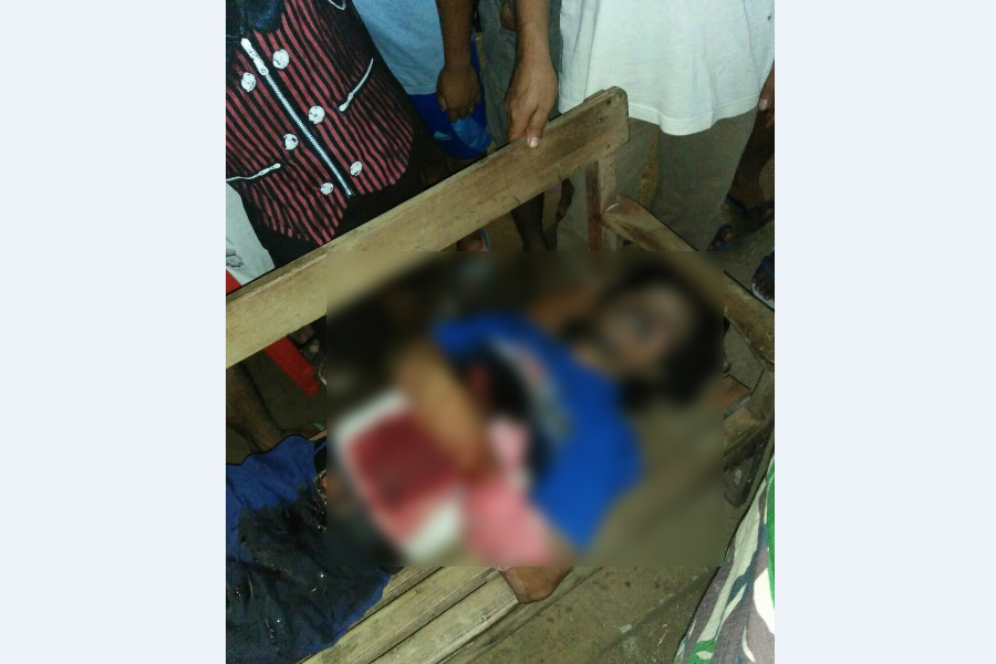 Warga Karatung Jadi Korban Penikaman