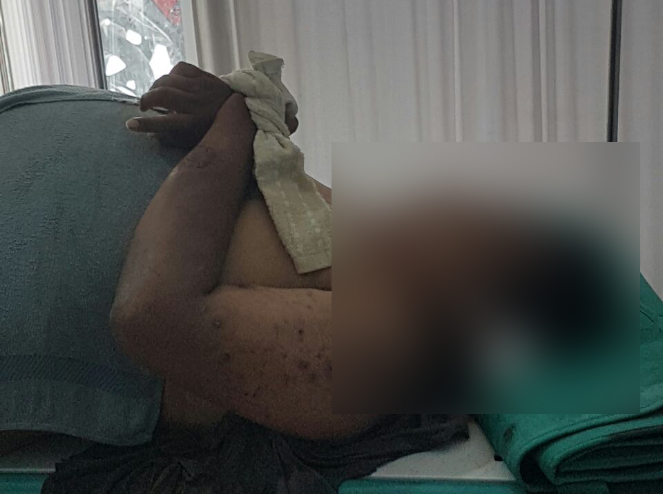 Alami Laka Tunggal, ASN Asal Tombatu Merenggang Nyawa